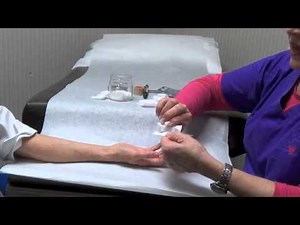 Allergy Patch Testing