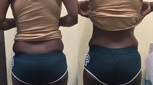 We offer non-invasive Body Contouring. Schedule your free consult today. —— Call/text 713-552-3300 or click the link in our bio to schedule directly | SkinTite Body Sculpting Spa