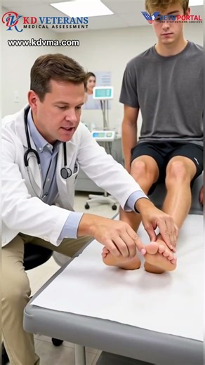 Why Flat Feet Get Underrated by the VA