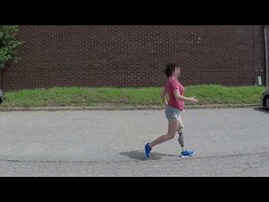 Hop-Skip Running - Above Knee Amputee (C-Leg)