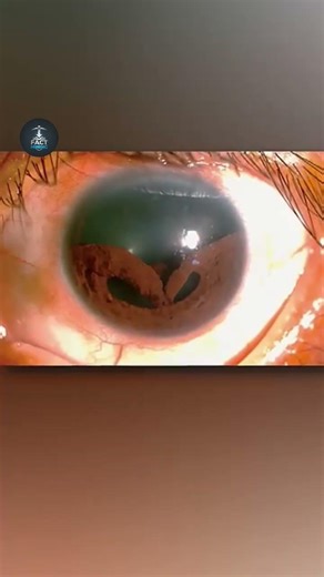 😱 Marne se pehle ye photos zaroor dekh lena! | Fact Mining