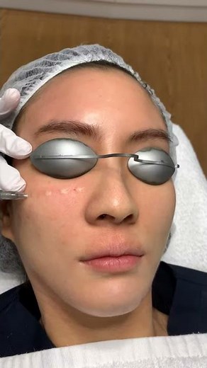 Rejuran Healer Skinbooster