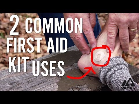 How To Use a Moleskin | First Aid with OSMEtv