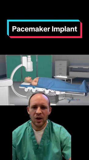 Pacemaker Implant! #pacemaker #icd #nurse #paramedic #greenscreenvideo #fyp