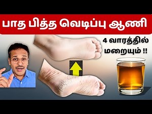 இந்த எண்ணெய் தடவினால் பித்த வெடிப்பு மறையும்! foot crack home remedies! skin care!
