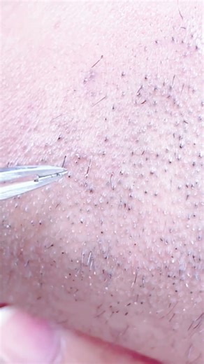 Pull out the feathers !! #asmr #satisfying #tweezer