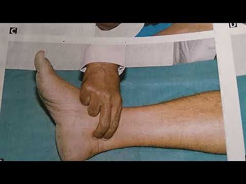 Medicine 083 a Posterior tibial artery pulse Medial Malleous how to feel peripheral Clinical