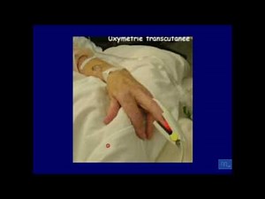 Semiology of respiratory failure Part 2