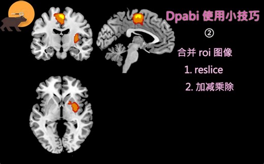 MRI roi的图像合并 dpabi小工具