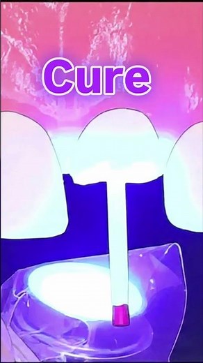 Post and core step by step guid |Dr.Dentique-hub