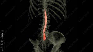 CT myelography with whole spine 3D rendering image is particularly sensitive at detecting small disk herniations compressing nerves of the spine from CT scanner. Stock Video