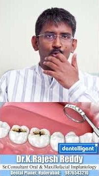 Ignored a Small Cavity? This Is How It Turns into a Root Canal | Dr. Rajesj Reddy | Dental Planet