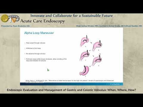 Endoscopic Evaluation and Management of Gastric and Colonic Volvulus: When, Where, How?