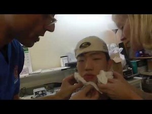 Preparation of Adult Orthotropics Headgear (Modified RAMPA System) by Dr Mike Mew Part 2