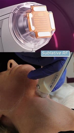 Konika Patel Schallen, MD on Instagram: "Let’s talk Sublative RF #MatrixMonday ✨ Sublative RF on the Matrix System is one of my favorite ways to resurface the skin while still stimulating collagen. Using bipolar radiofrequency energy, we can improve texture, fine lines, pores, and acne scarring—all with minimal downtime. It’s light ablation with deep dermal stimulation. I like to use 30-45 mJ around the eyes and 60-80 mJ on the neck with a pass at a lower energy as well for a variety of depths. 