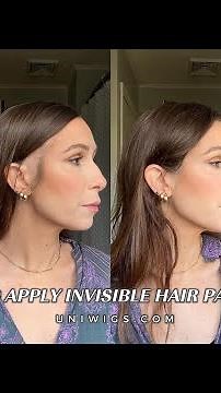 Hair Patches | How to apply invisible hair patches & cover up hairloss area