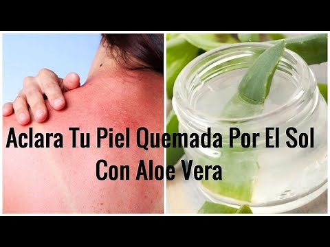 aclara tu piel quemada por el sol con aloe vera