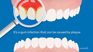 4.2K views · 27 reactions | You hear your hygienist talk about it,...