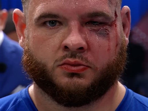 One of The Most BRUTAL Slap Fights at Power Slap EVER 🤯 | Nick Savage