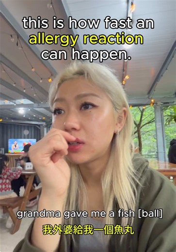 seafood-allergy friends LISTEN UP 📢🐟🚫🙅🏻‍♀️ THROWBACK VID ‼️when i lived in Korea i would occasionally eat fish cake 🍥 as i had no problem… so naturally, my head went to “oh i can eat fish cake/ball (?) in Taiwan….” Bruh. I was wrong…. 💀 JUST MAKING THIS SO YOU DONT MAKE THE SAME MISTAKE — i know it was dumb but it happens…. 😅 👉 @joanneffan for more food allergy life :) #justjoanneintaiwan #justjoannefoodallergies #seafoodallergy #allergylife #travelingwithfoodallergies