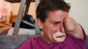 What started out as the flu ended with Alex losing all of his limbs. via Real Stories | WHAT WE SEEE