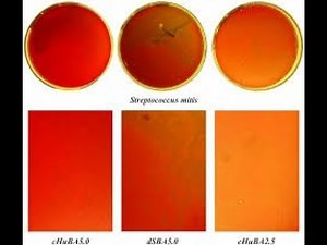Streptococcus Mitis ; Characteristics, Infections, Virulence factors, Transmission, Treatment