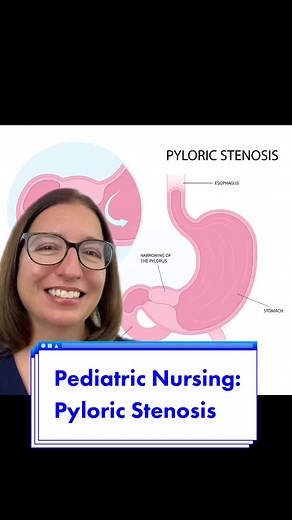 Understanding Pyloric Stenosis in Nursing School: Symptoms & Treatment Explained