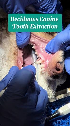Deciduous canine teeth have long, delicate roots and require a controlled, ligament-focused approach to minimize trauma and protect the permanent tooth bud. In this video, extraction is performed using @veterinarydentistry Veterinary Dental Instruments Deciduous Canine Extraction Set, beginning with 2.0 mm and 2.5 mm double-ended periotomes to sharply excise the periodontal ligament and access flat tooth surfaces, followed by 1.3 mm concave and convex deciduous canine luxator elevators for preci