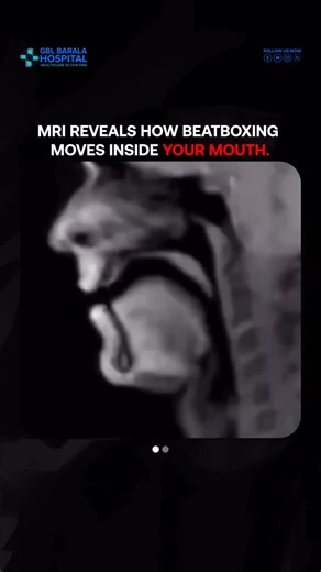GBL Barala Hospital | Beatboxing isn’t just sound — it’s a full-body technique happening inside the mouth, tongue, throat, and lips. MRI scans reveal how... | Instagram