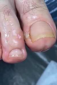 183K views · 52 reactions | Full process of callus removal! | Make-Up & Hair Tutorials | Facebook