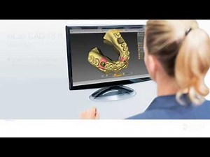 inLab CAD 18.0 Erstellen und modifizieren eines Implantat Modells