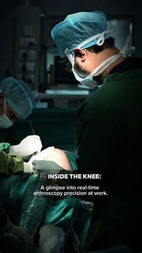🎥 Inside the Knee: A glimpse into real-time arthroscopy precision at work.