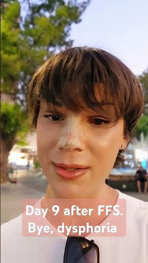 FFS recovery timeline Facial feminization surgery male to female gender transition #mtf #transgender