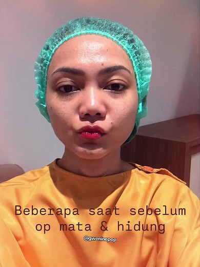 Rina Nose Operasi Mata dan Hidung: Transformasi Menakjubkan