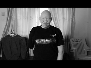 タンザニア：魔術のために襲われるアルビノの子どもたち /日本ユニセフ協会