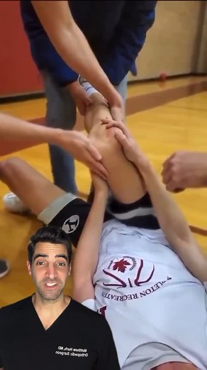 Matthew Harb on Instagram: "Here’s a comprehensive breakdown of the diagnosis and treatment/reduction of a lateral patella dislocation, including immediate steps and follow-up care. ✅ Lateral Patella Dislocation: Overview Definition:A lateral patella dislocation occurs when the kneecap (patella) moves out of its normal position in the trochlear groove of the femur, almost always laterally (to the outside of the knee). It often results from a twisting injury, a direct blow, or a sudden directiona