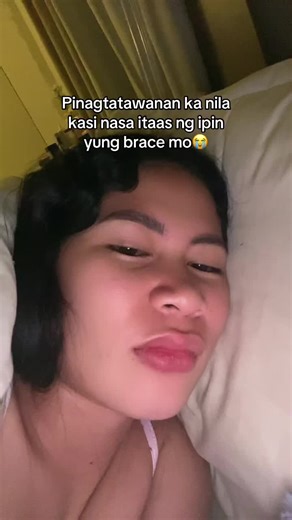 Braces Journey: Tips and Experiences