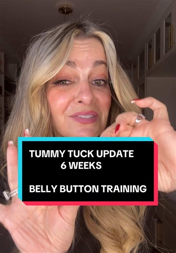 Tummy, tuck and liposuction update, and going over belly button training and scar management #TummyTuck #TummyTuckJourney #Abdominoplasty #MommyMakeover #MommyMakeoverUpdate