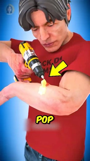 Watch This! Don’t Ever Pop a Blister Until You See This ‼️😱