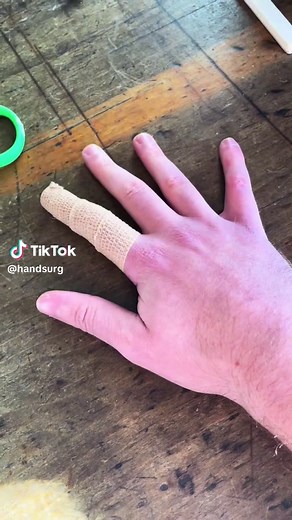 How to Apply a Finger Splint Quickly