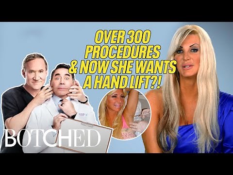 Sarah the BIONIC WOMAN Has Spent Over $3M to Look Like a Completely Different Person | Botched | E!