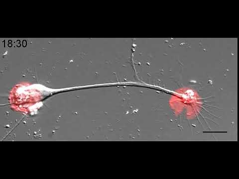 Cytoskeletal Mechanisms of Axonal Contractility