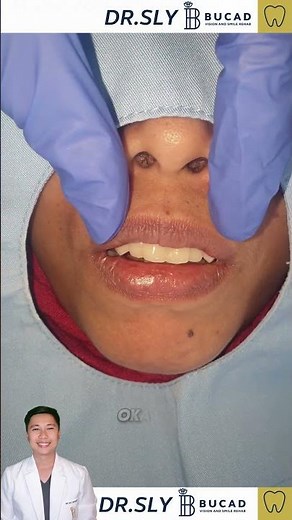 "Fix Bridge Done in Just 1.5 Hours"