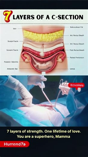 Anatomy of a C-Section: Cutting Through 7 Layers Explained