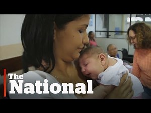 Zika Virus | What Is Microcephaly?