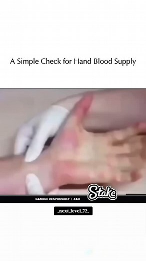 Next Level 💀 | Allen’s Test: Assessing Blood Flow in the Hand The Allen test is a simple procedure used to evaluate the blood supply to the hand before... | Instagram