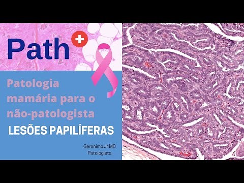 Lesões Papilíferas - Patologia mamária para o não-patologista.