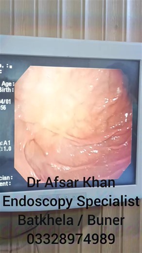 Understanding Endoscopy and Its Impact on Health