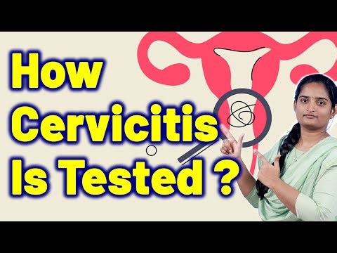 Essential Tests For Cervicitis, Acute Cervicitis, Cervical Swelling. Treatment Medicine Gynaecology