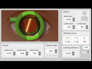 Lecture 2: Retinoscopy, Part 2: Retinoscopy on simulator.